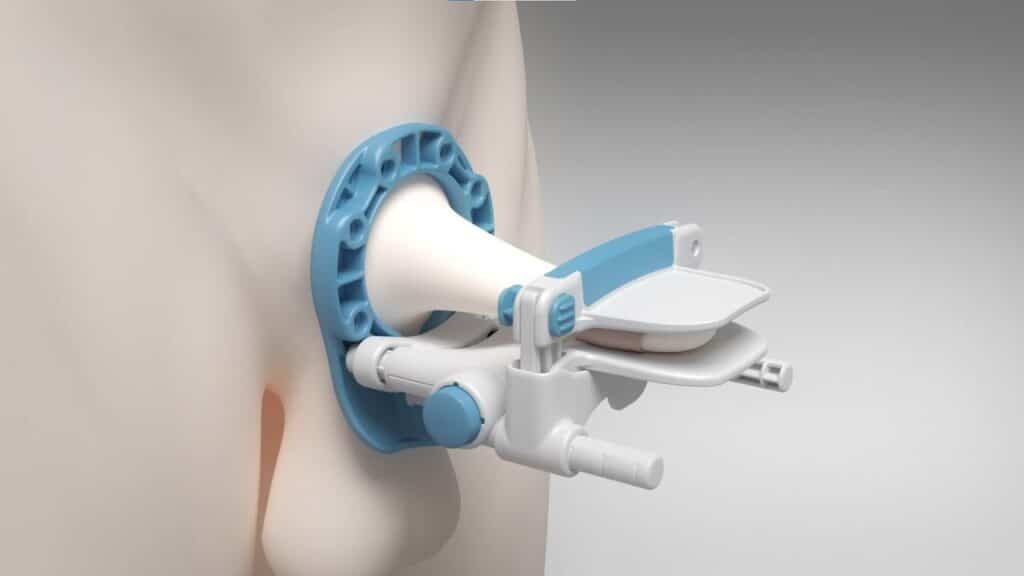 Understanding Penile Traction Device Results: What to Expect and How It Works 1 Penile Traction Device